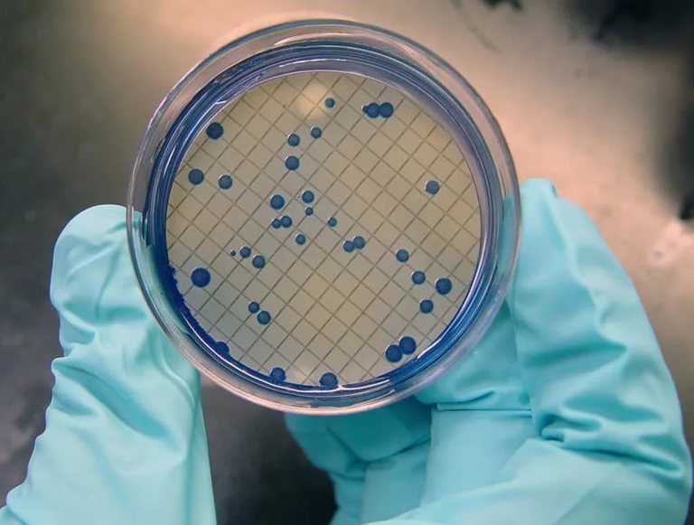 Бактерии, содержащиеся в отходах, найдены в питьевой воде в ЗКО