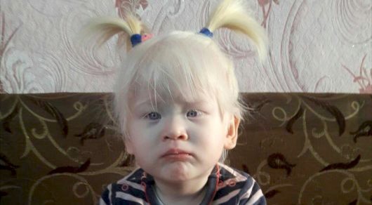 Уникальная малышка: В Уральске живет девочка-альбинос (фото)
